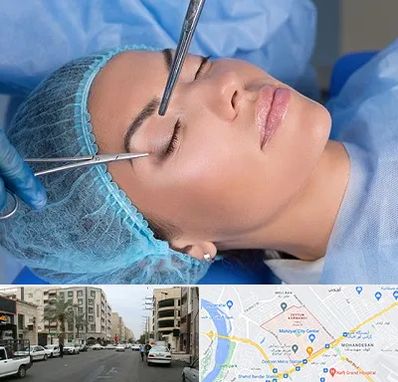 جراحی لیفت ابرو در زیتون کارمندی اهواز