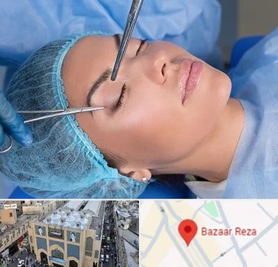 جراحی لیفت ابرو در بازار رضا مشهد