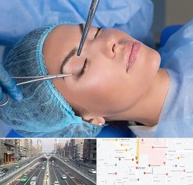 جراحی لیفت ابرو در توحید 