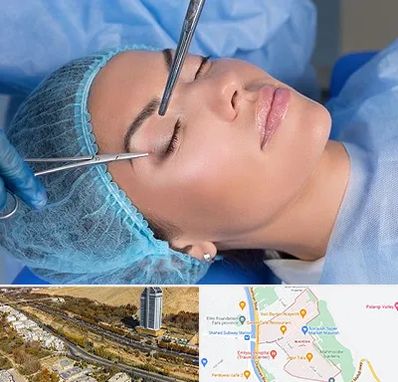 جراحی لیفت ابرو در خیابان نیایش شیراز