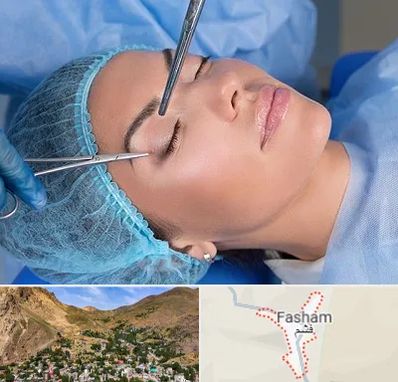 جراحی لیفت ابرو در فشم