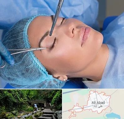 جراحی لیفت ابرو در علی‌ آباد کتول