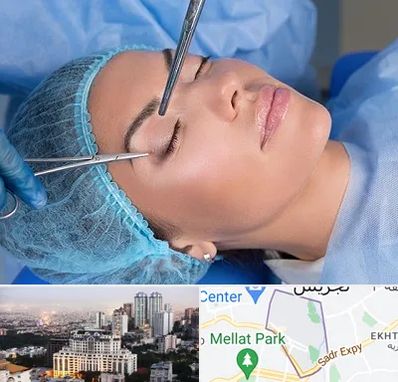 جراحی لیفت ابرو در الهیه 