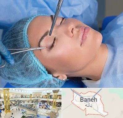 جراحی لیفت ابرو در بانه