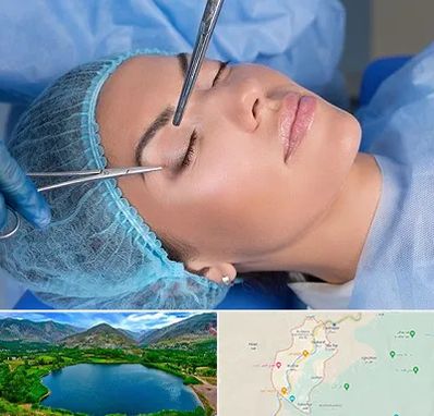 جراحی لیفت ابرو در رودبار
