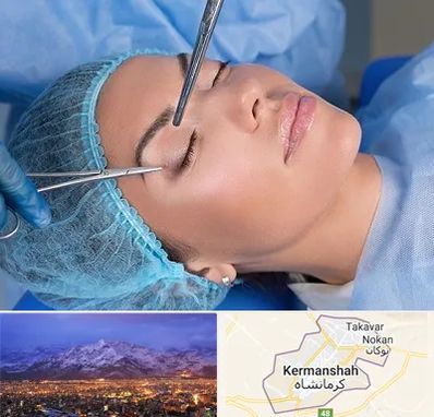 جراحی لیفت ابرو در کرمانشاه