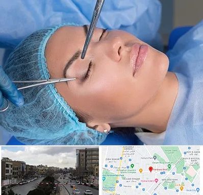 جراحی لیفت ابرو در بلوار فردوسی مشهد