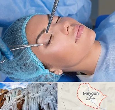 جراحی لیفت ابرو در میگون