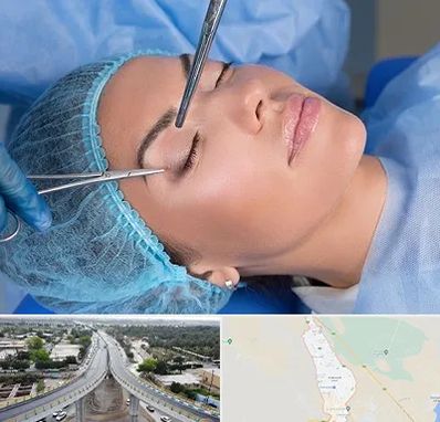 جراحی لیفت ابرو در اندیمشک