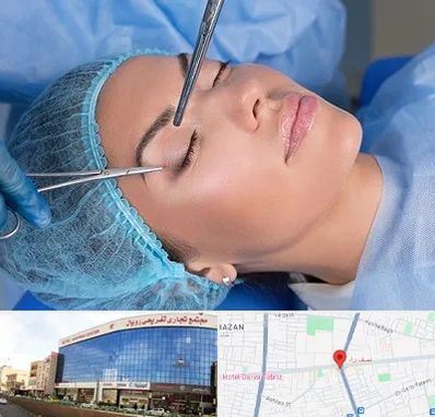 جراحی لیفت ابرو در نصف راه تبریز