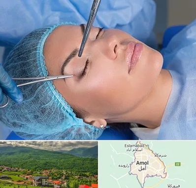 جراحی لیفت ابرو در آمل