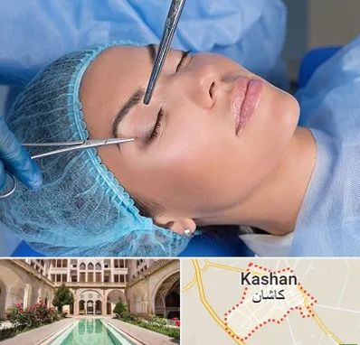 جراحی لیفت ابرو در کاشان