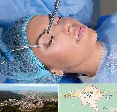 جراحی لیفت ابرو در گرگان