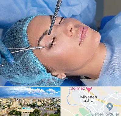 جراحی لیفت ابرو در میانه