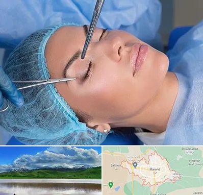 جراحی لیفت ابرو در مرند