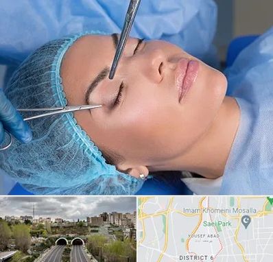 جراحی لیفت ابرو در یوسف آباد 