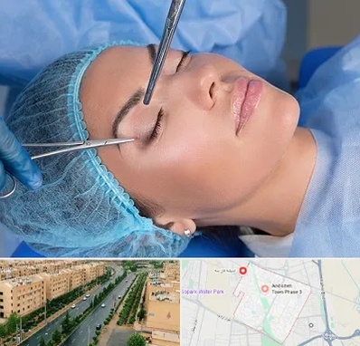جراحی لیفت ابرو در فاز سه اندیشه