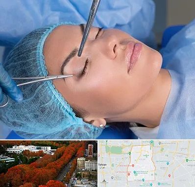 جراحی لیفت ابرو در منطقه 6 تهران 