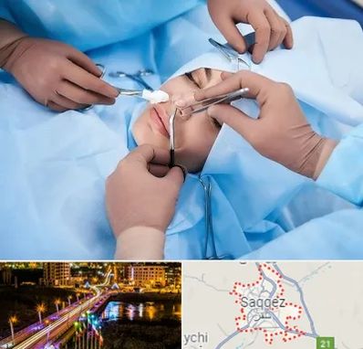 عمل بینی فانتزی در سقز