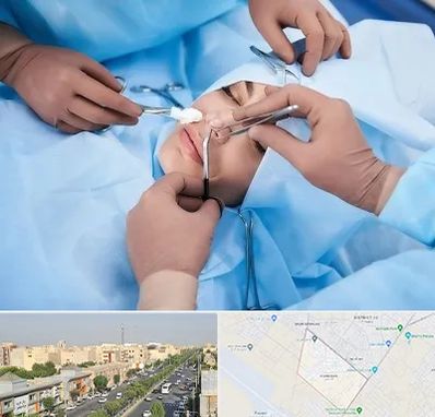 عمل بینی فانتزی در کیانمهر کرج