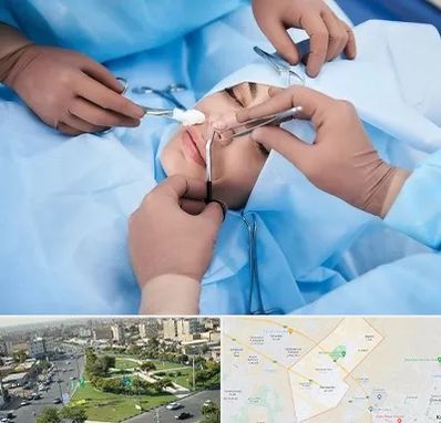 عمل بینی فانتزی در کمال شهر کرج