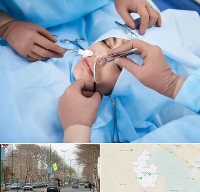 عمل بینی فانتزی در نظرآباد کرج