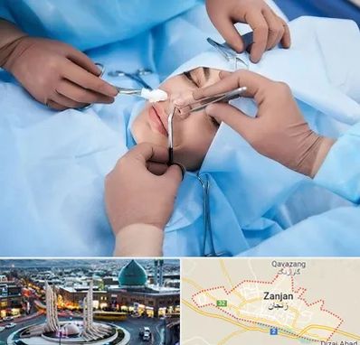 عمل بینی فانتزی در زنجان