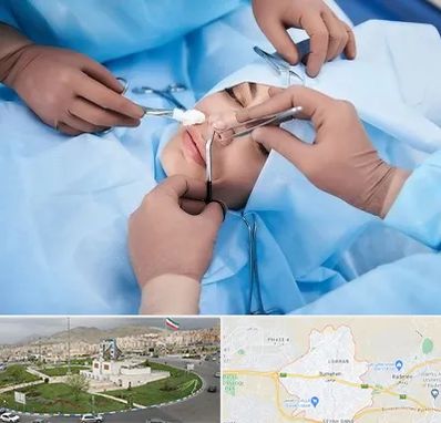 عمل بینی فانتزی در بومهن