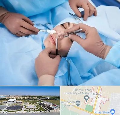 عمل بینی فانتزی در ملارد