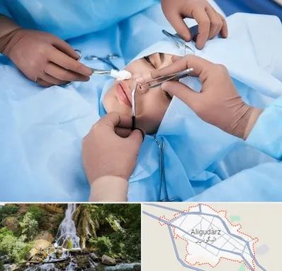 عمل بینی فانتزی در الیگودرز