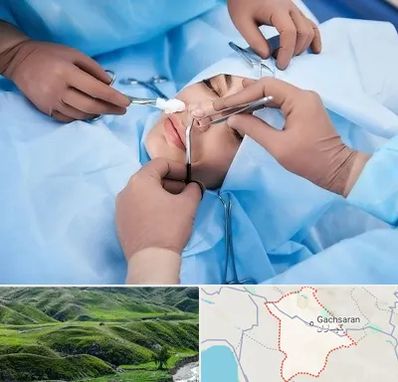 عمل بینی فانتزی در گچساران