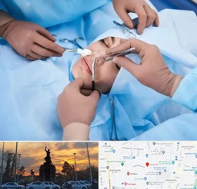 عمل بینی فانتزی در میدان حر 