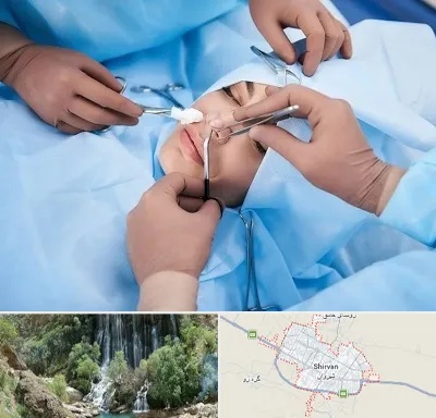 عمل بینی فانتزی در شیروان