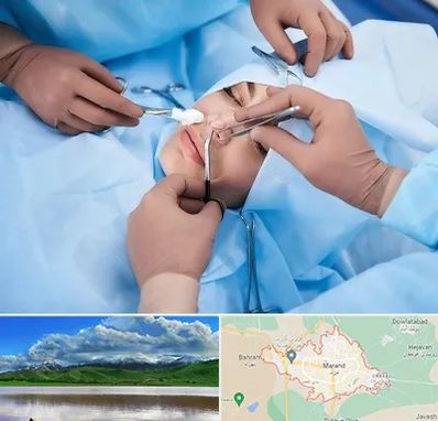 عمل بینی فانتزی در مرند