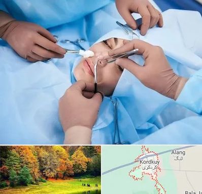 عمل بینی فانتزی در کردکوی