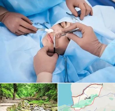 عمل بینی فانتزی در گلستان