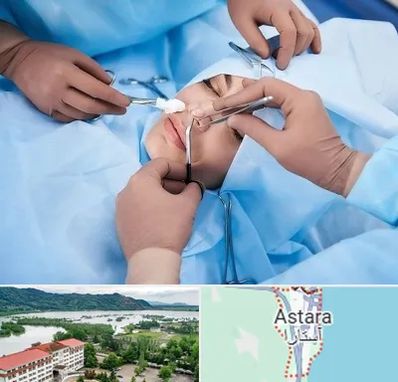 عمل بینی فانتزی در آستارا