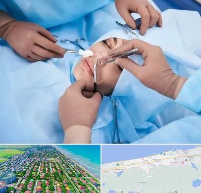 عمل بینی فانتزی در فریدونکنار