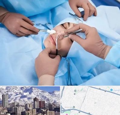 عمل بینی فانتزی در ازگل