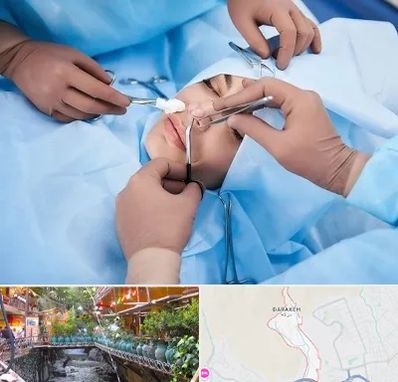 عمل بینی فانتزی در درکه