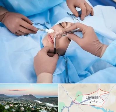 عمل بینی فانتزی در لواسان