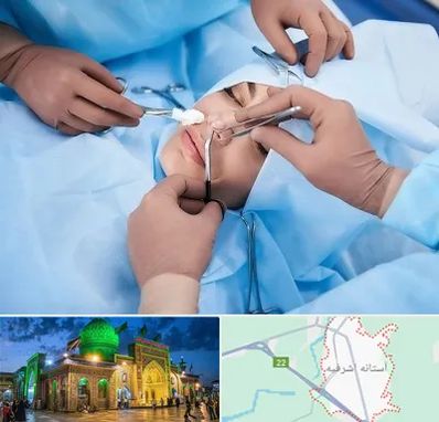 عمل بینی فانتزی در آستانه اشرفیه