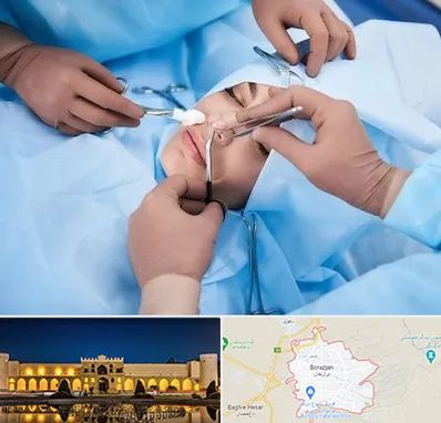 عمل بینی فانتزی در برازجان