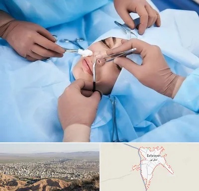 عمل بینی فانتزی در اسفراین