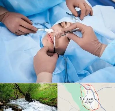 عمل بینی فانتزی در نهاوند
