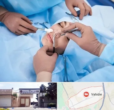 عمل بینی فانتزی در وحیدیه شهریار