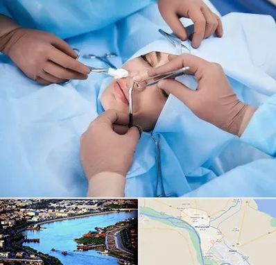 عمل بینی فانتزی در خرمشهر