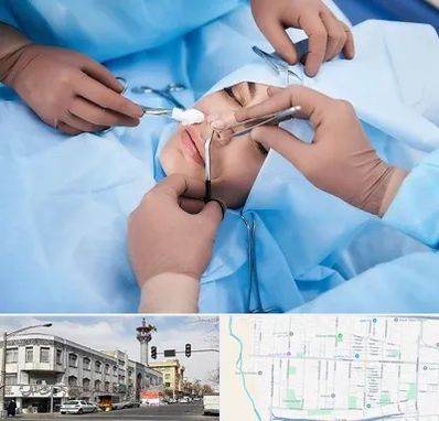 عمل بینی فانتزی در 17شهریور