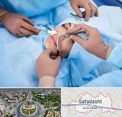 عمل بینی فانتزی در صفادشت