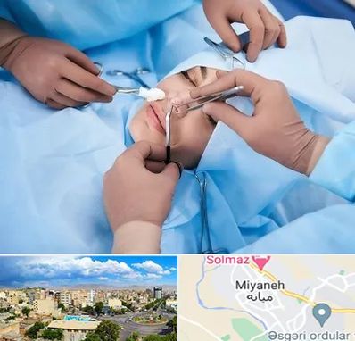 عمل بینی فانتزی در میانه